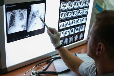 lung ct scan lung ct scan