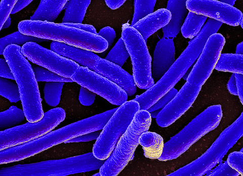 E. coli NIH Colorized scanning electron micrograph of Escherichia coli, grown in culture and adhered to a cover slip.