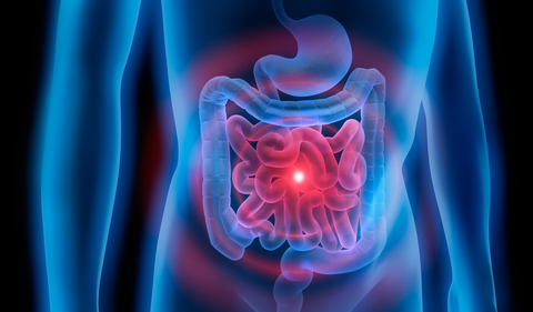 Body with stomach and colon problem Stomach with colon
