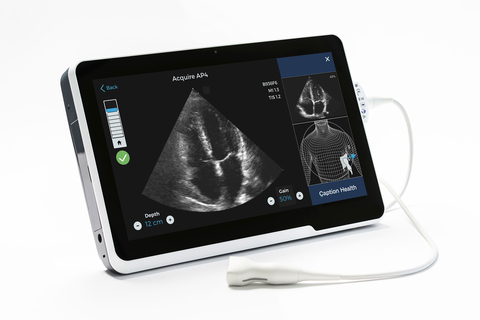 Caption Health ultrasound AI Caption Guidance