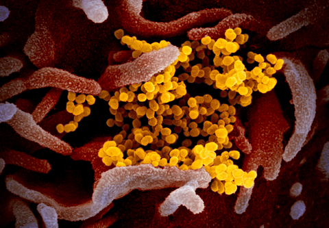 NIAID Coronavirus Novel Coronavirus SARS-CoV-2