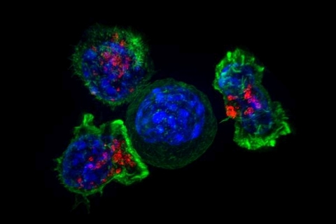 cancer cell surrounded by killer T cells cancer cell surrounded by killer T cells