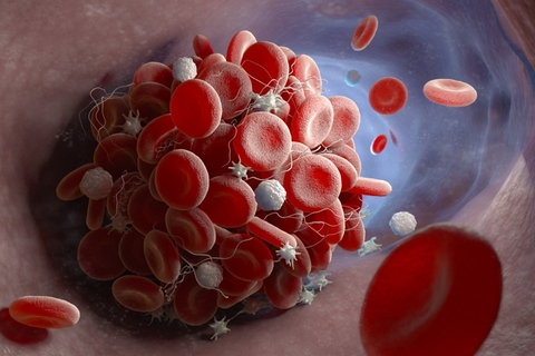 blood clot blood clot