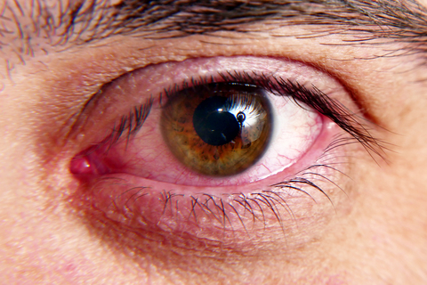 Red squirrel eyes, macro photo Dry eye