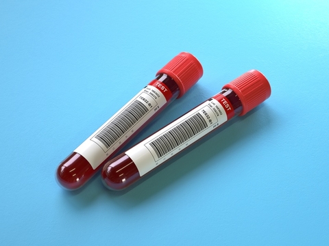 blood test tube blood test tube