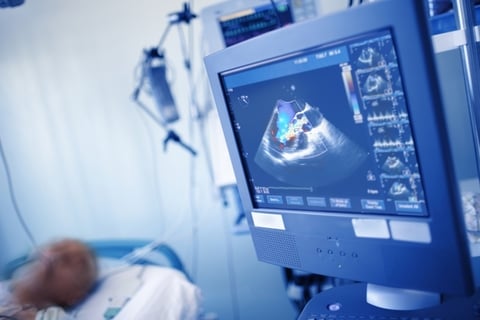 Cardiac ultrasound