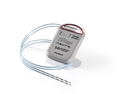 Senza--Courtesy of Nevro Senza spinal cord stimulator