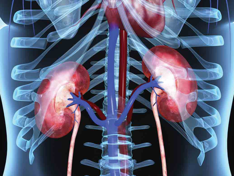 Kidneys Patients undergoing kidney dialysis must have their hydration level closely monitored; a newly-developed portable sensor makes it