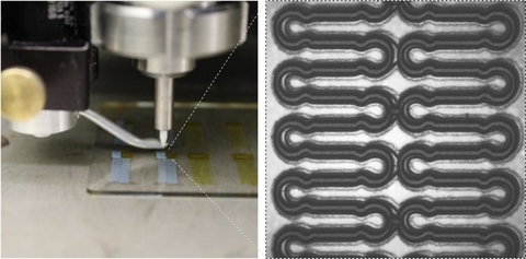 Georgia Tech develops stretchable wireless sensor to treat cerebral aneurysms Georgia Tech develops stretchable wireless sensor to treat cerebral aneurysms