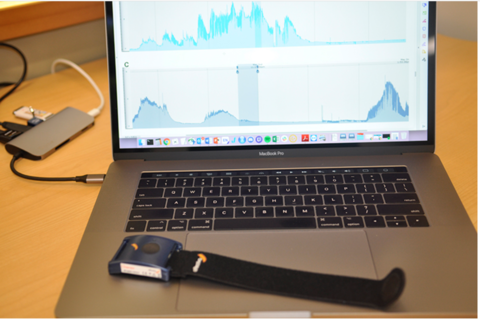 University of Missouri uses sweat sensors to monitor child autism University of Missouri uses sweat sensors to monitor child autism