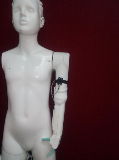 3D prosthetic arm 3D prosthetic arm