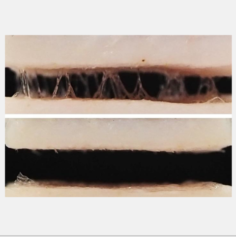 Poly vinyl alcohol becomes wearable sensor adhesive Poly vinyl alcohol becomes wearable sensor adhesive