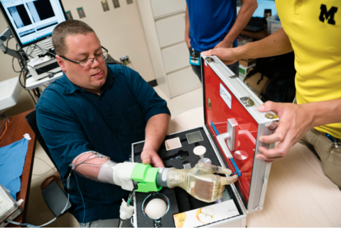 Faint nerves give amputees control of robotic hand Faint nerves give amputees control of robotic hand