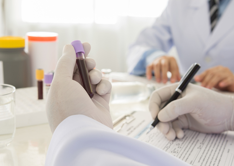 Blood sample Blood sample