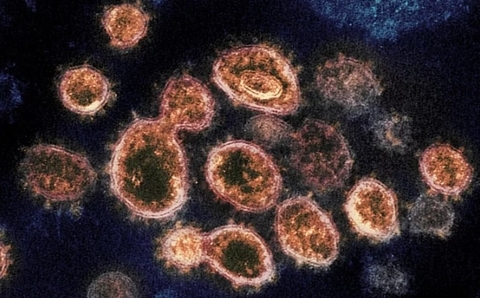 coronavirus nih coronavirus nih