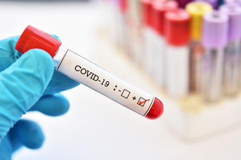 COVID-19 test A person holds a positive COVID-19 test