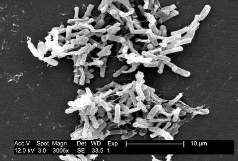 Clostridium difficile C. diff