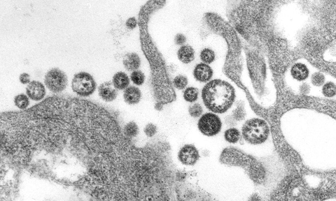 LassaFever Lassa fever