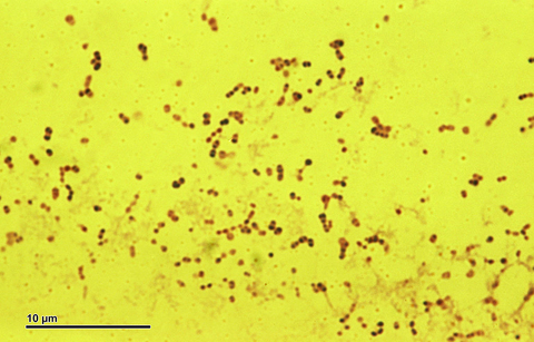 pneumococcal virus Prevnar pneumococcal virus microscope image