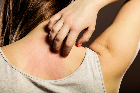 Itching Skin via Shutterstock Dermatologist