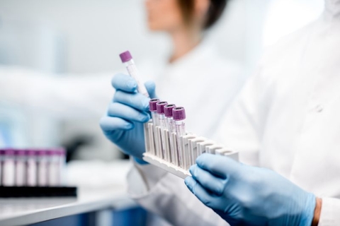 coronavirus test tubes coronavirus test tubes