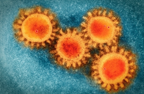 Coronavirus Sars-CoV-2 under an electron microscope