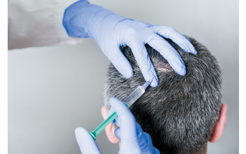 Botox Treatment Botox Treatment