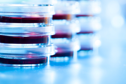 medical research petri dishes in a lab