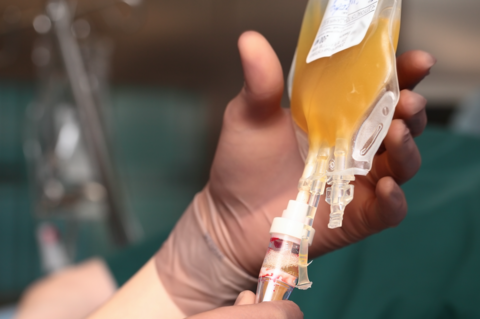 Convalescent plasma A picture of donated plasma