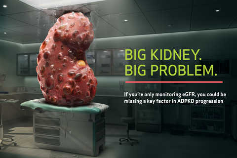 Otsuka Big Kidney Big Trouble campaign website image Otsuka Big Kidney Big Trouble campaign website image