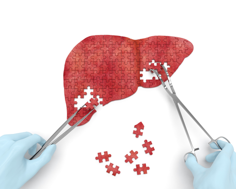 liver puzzle Gloved hands putting together a liver out of puzzle pieces