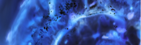 viral vector viral vector
