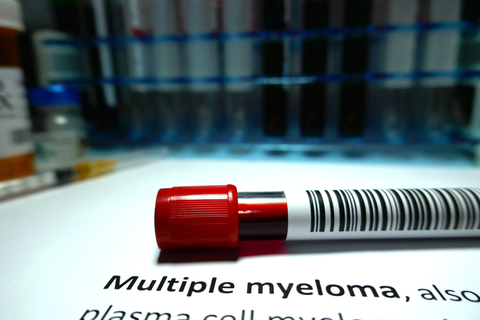 Multiple Myeloma Hailshadow/GettyImages
