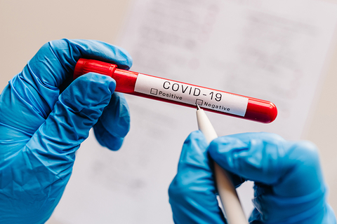 coronavirus test coronavirus test