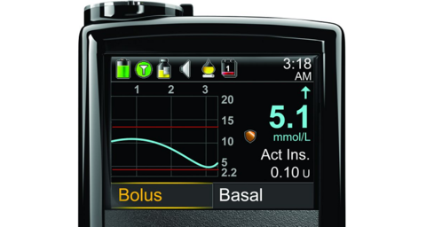 Medtronic's closed loop system
