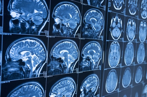brain imaging brain imaging