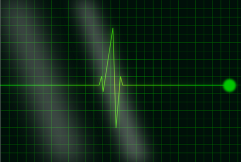 ecg ecg
