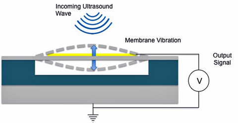 Fig. 4: Ultrasound receive mode.