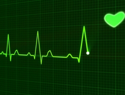 Heart monitor Heart monitor