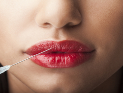 Botox Lips NikiLitov/iStock / Getty Images Plus Botox Lips NikiLitov/iStock / Getty Images Plus