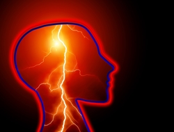 Migraine headache/epilepsy brain image Migraine headache/epilepsy brain image