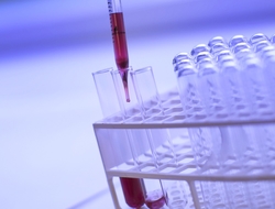 test tubes test tubes