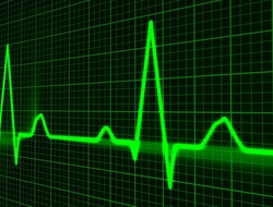 heartbeat EKG rhythm