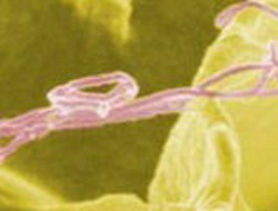 monoclonal antibodies (mAbs) monoclonal antibodies