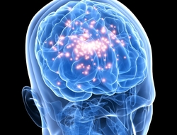 Leti, epilepsy dianoses, brain surgery, space quantum sensor Leti’s space quantum sensor.