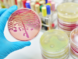 Bacteria culture lab gloved hand holding up bacteria culture