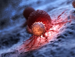 lymphocytes attacking cancer cells lymphocytes