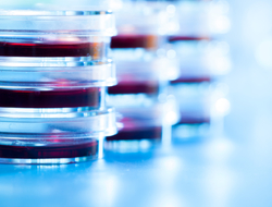 medical research petri dishes in a lab