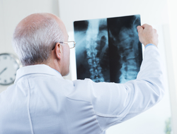 Spine x-ray (Credit: Getty/cyano66) doctor looking at x-ray of spine