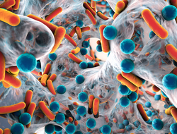 Antibiotic-resistant bacteria Antibiotic-resistant bacteria